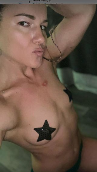 Felice Herrig